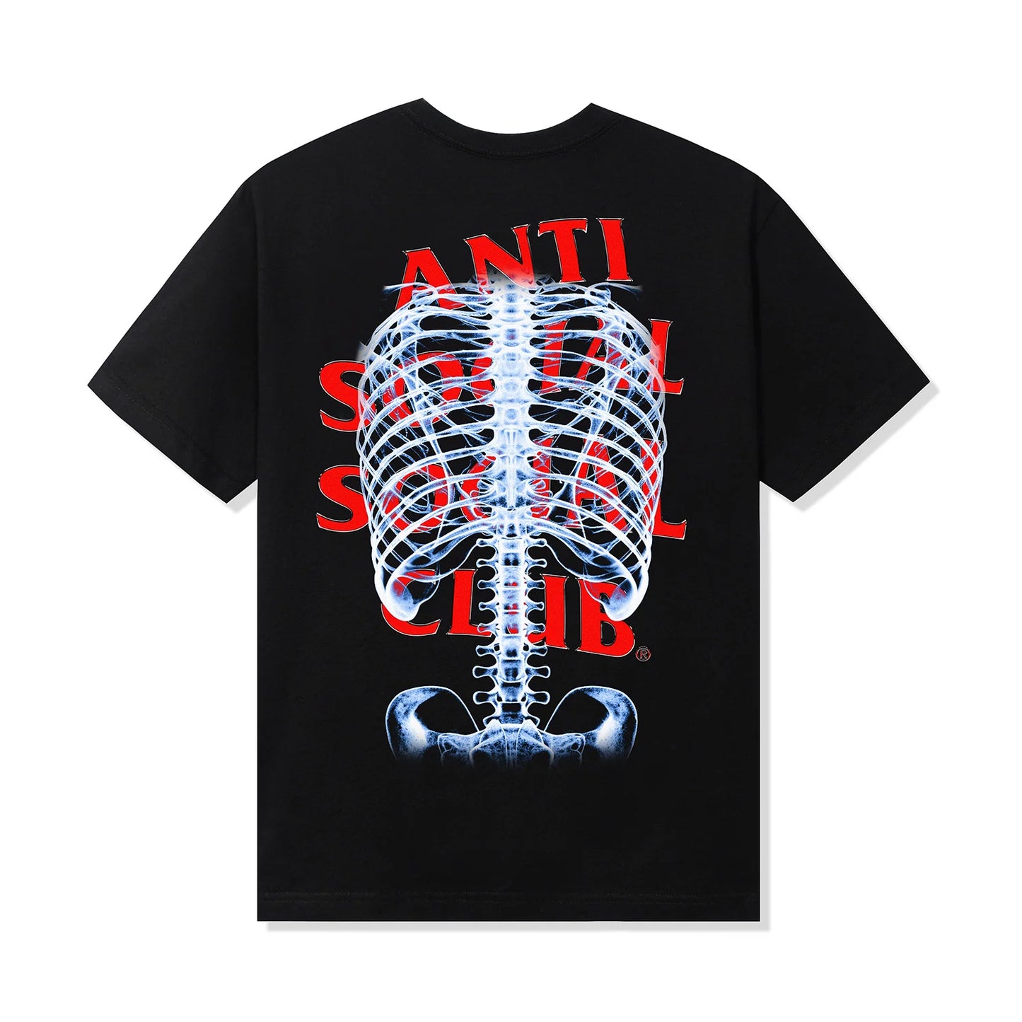 ANTI SOCIAL SOCIAL CLUB BONES TEE- BLACK