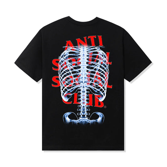 ANTI SOCIAL SOCIAL CLUB BONES TEE- BLACK