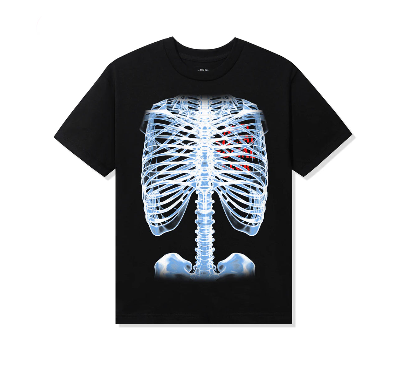 ANTI SOCIAL SOCIAL CLUB BONES TEE- BLACK